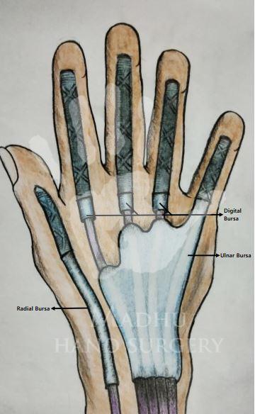 Bursa of the hand