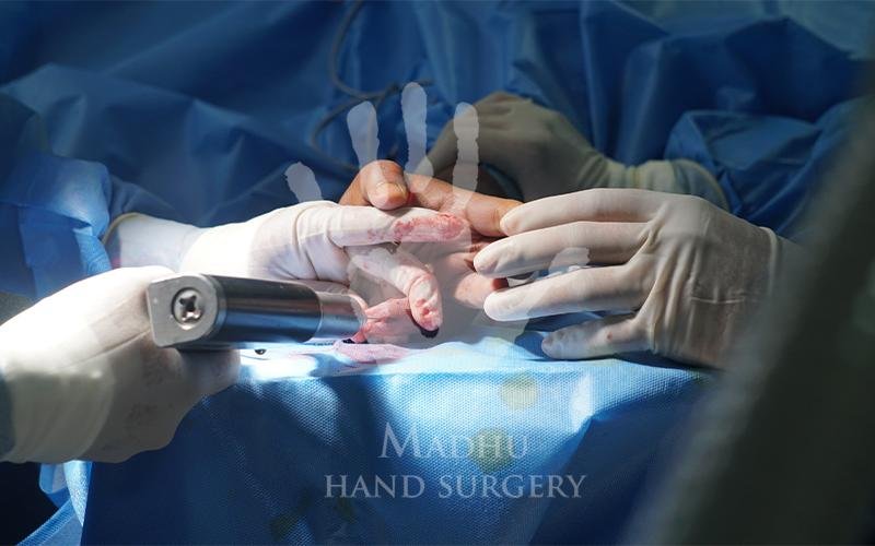 Advanced Orthopedic Hand Treatment