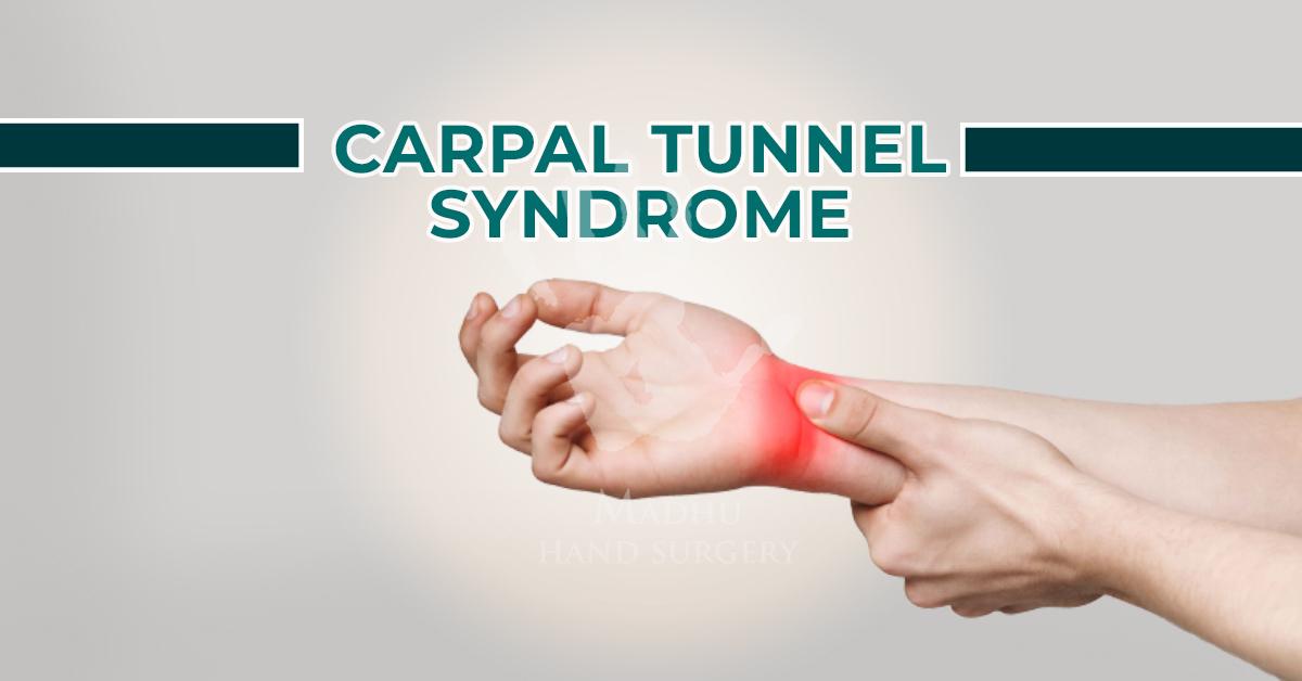 Causes of Carpal Tunnel Syndrome