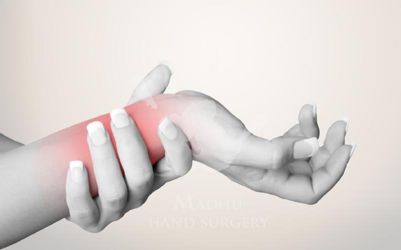 Symptoms of Carpal Tunnel Syndrome