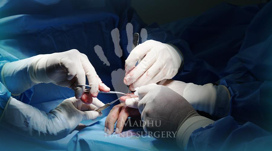 Dr.Madhusudhan NC surgery