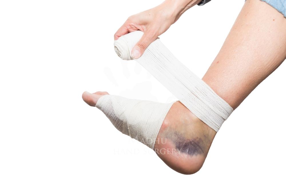 Sprains & Strains