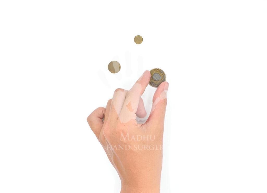 Finger Pinches