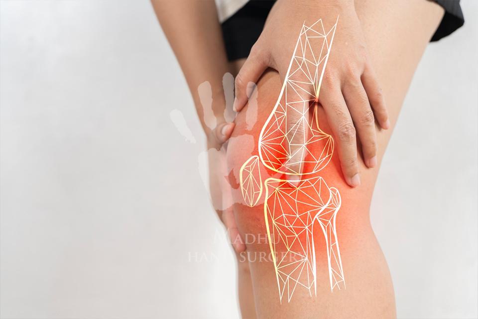 Knee pain