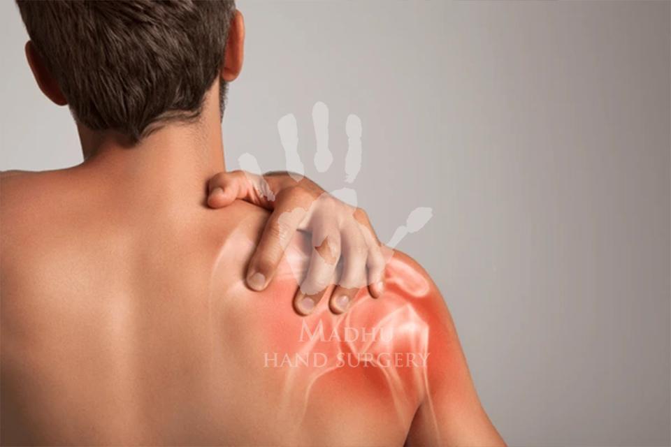 Frozen shoulder pain