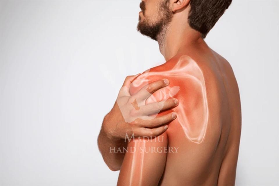 Pain in shoulder