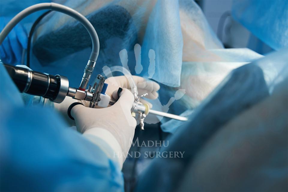 Hip Arthroscopy