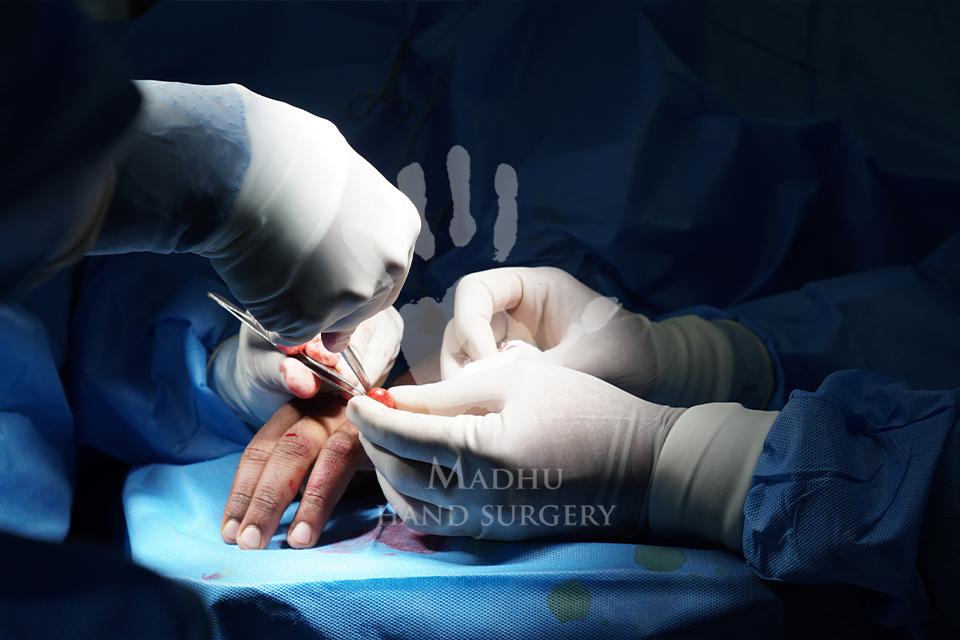 Nerve Injury and Reconstruction