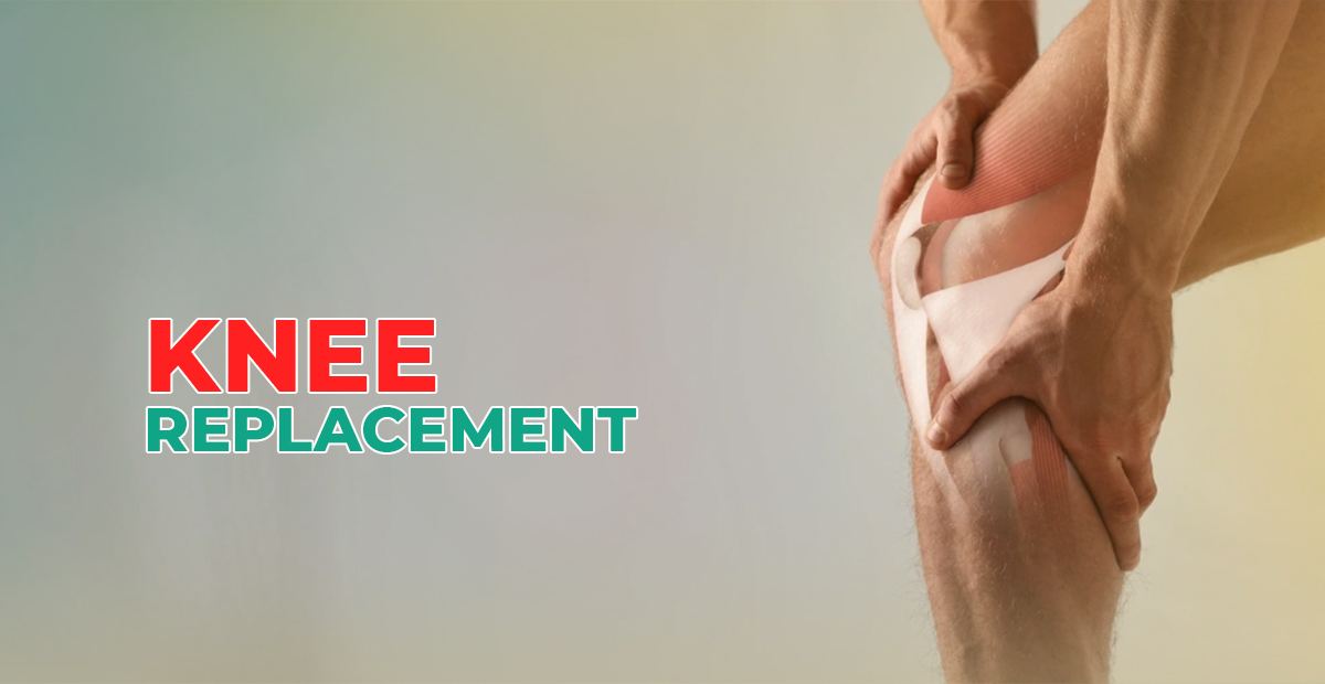 Knee Replacement Surgery