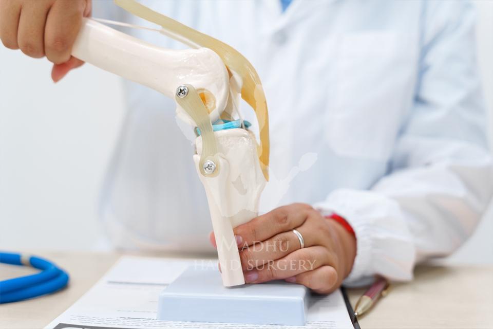 Knee replacement surgery