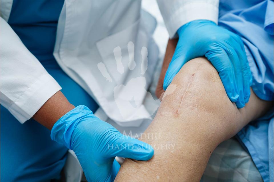Patient after knee surgery