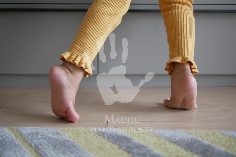 Toe Walking