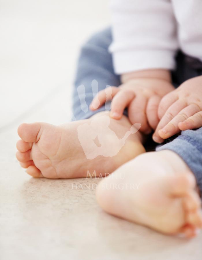 Toe walking in child