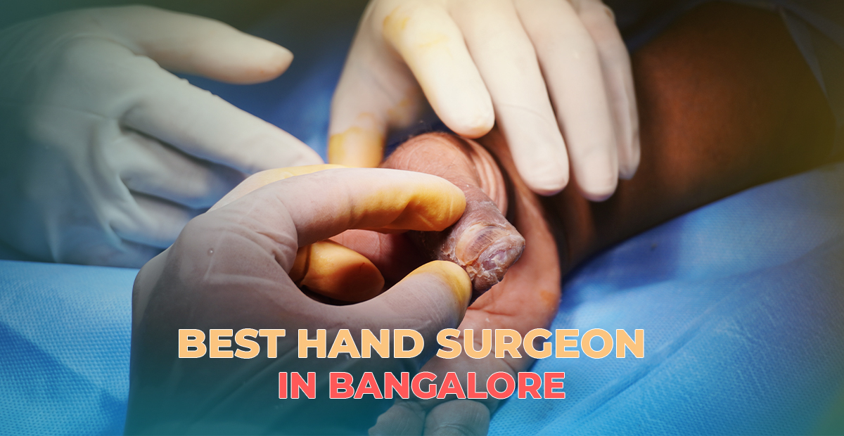 best hand surgeon in Bangalore