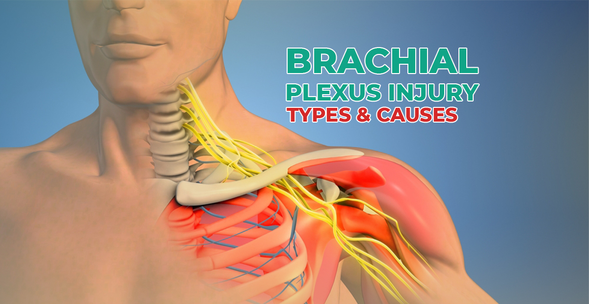 Brachial Plexus Injury