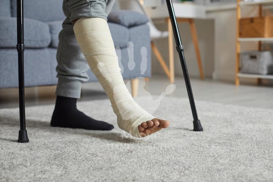 Leg Fracture