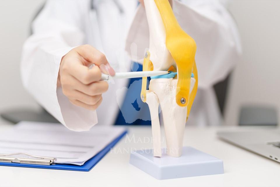 Ligament