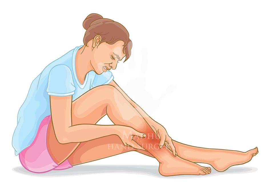 Swelling