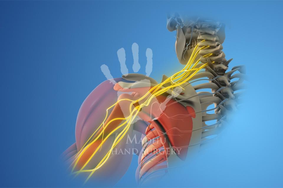 brachial plexus nerves 