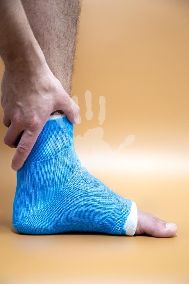 Ankle Fracture
