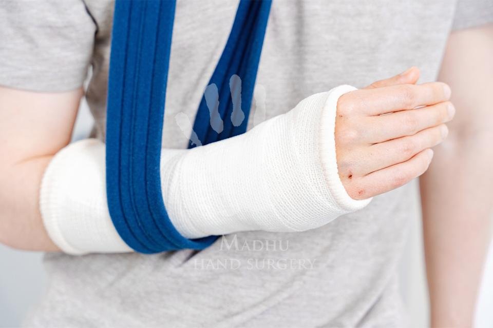 Hand fracture