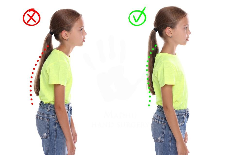 Kids poor posture