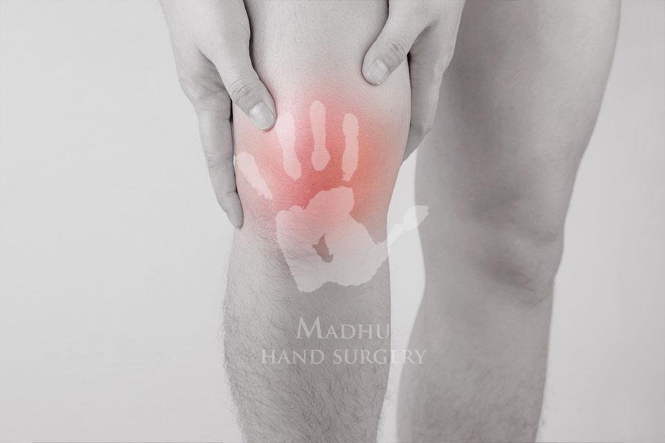 Swollen knees
