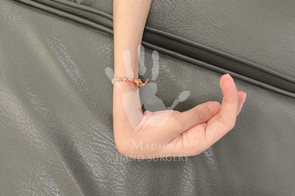 Deformity or Injury After a Fall