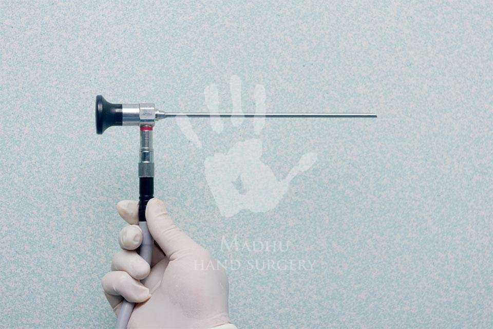 arthroscope